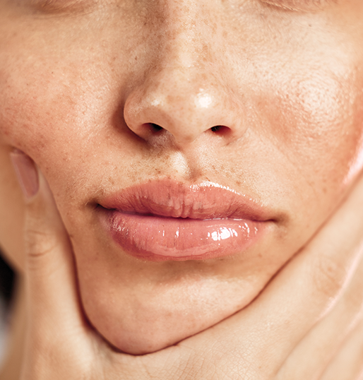 Dermal Fillers
