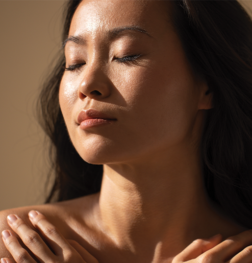Melasma