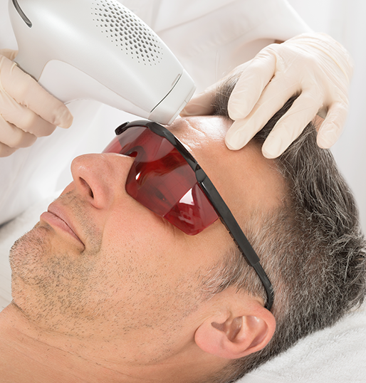 Laser Skin Resurfacing